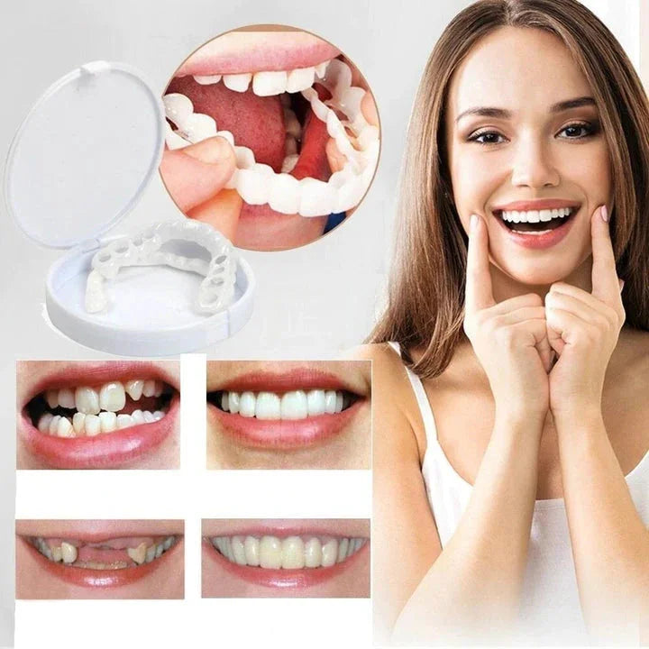 Easy Fit Snap On Smile Veneers For Upper Lower Teeth - VogeLuxe