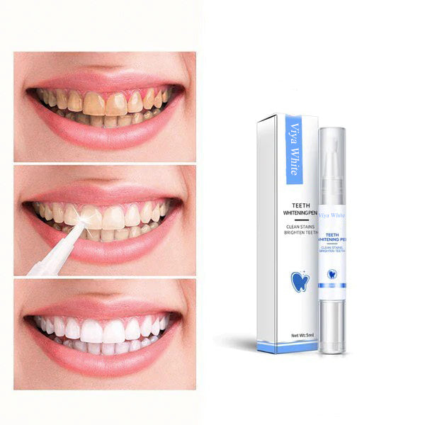 Fast At Home Teeth Whitening Kit - VogeLuxe