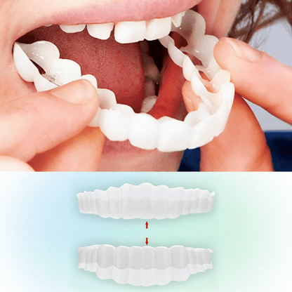 Snap On Custom Dental Veneers for Perfect Smile