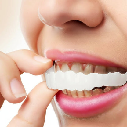 Snap On Custom Dental Veneers for Perfect Smile - VogeLuxe