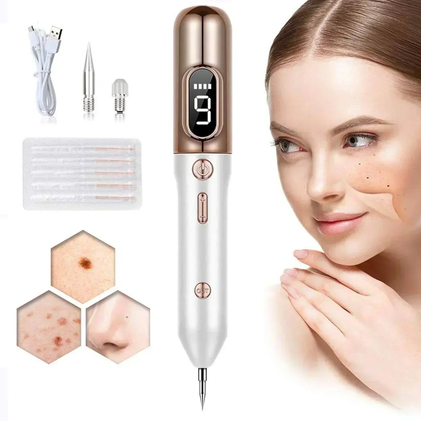 Professional Skin Tag Removal Plasma Pen Device - VogeLuxe