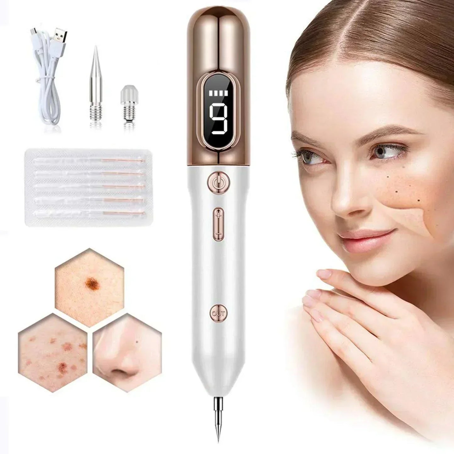 Professional Skin Tag Remover Pen 9 Adjustable Levels - VogeLuxe